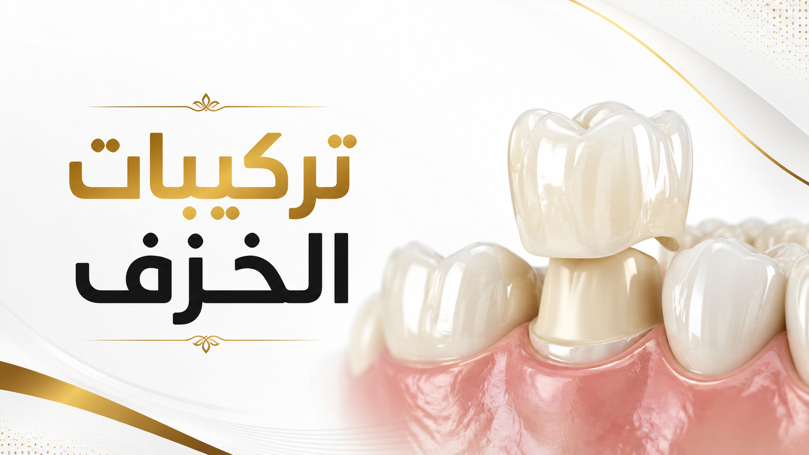 تركيبات خزف في صنعاء