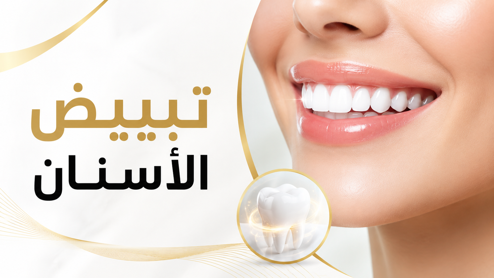 تبييض الأسنان في صنعاء
