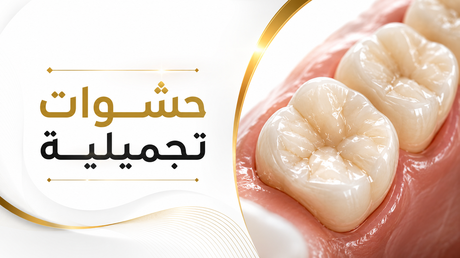 حشوات تجميلية في صنعاء